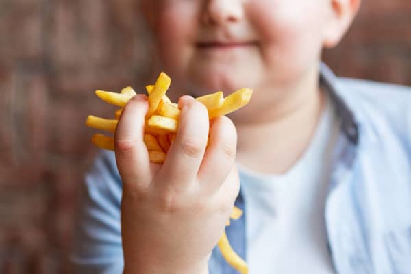 Alternativas para a diminuição da obesidade infantojuvenil no Brasil